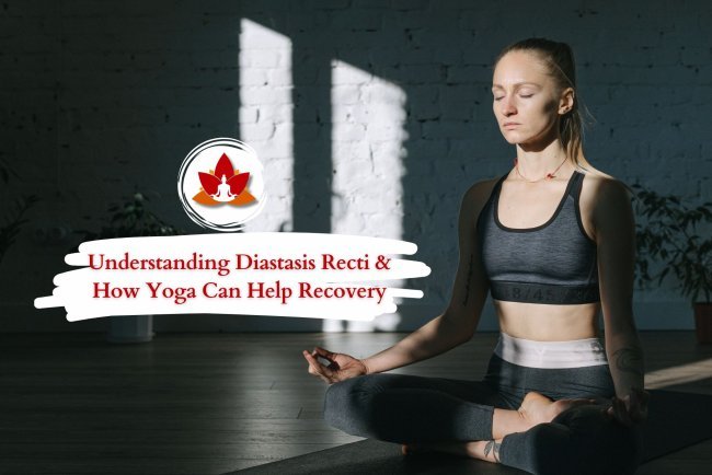 Understanding Diastasis Recti & How Yoga Can Help Recovery
