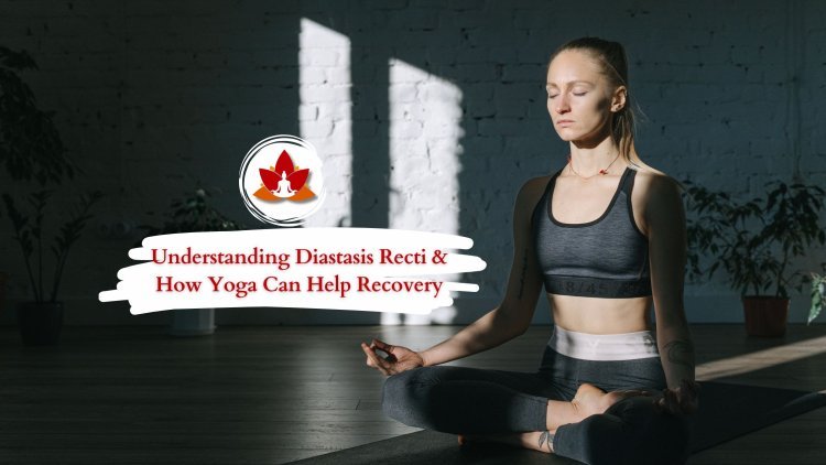 Understanding Diastasis Recti & How Yoga Can Help Recovery